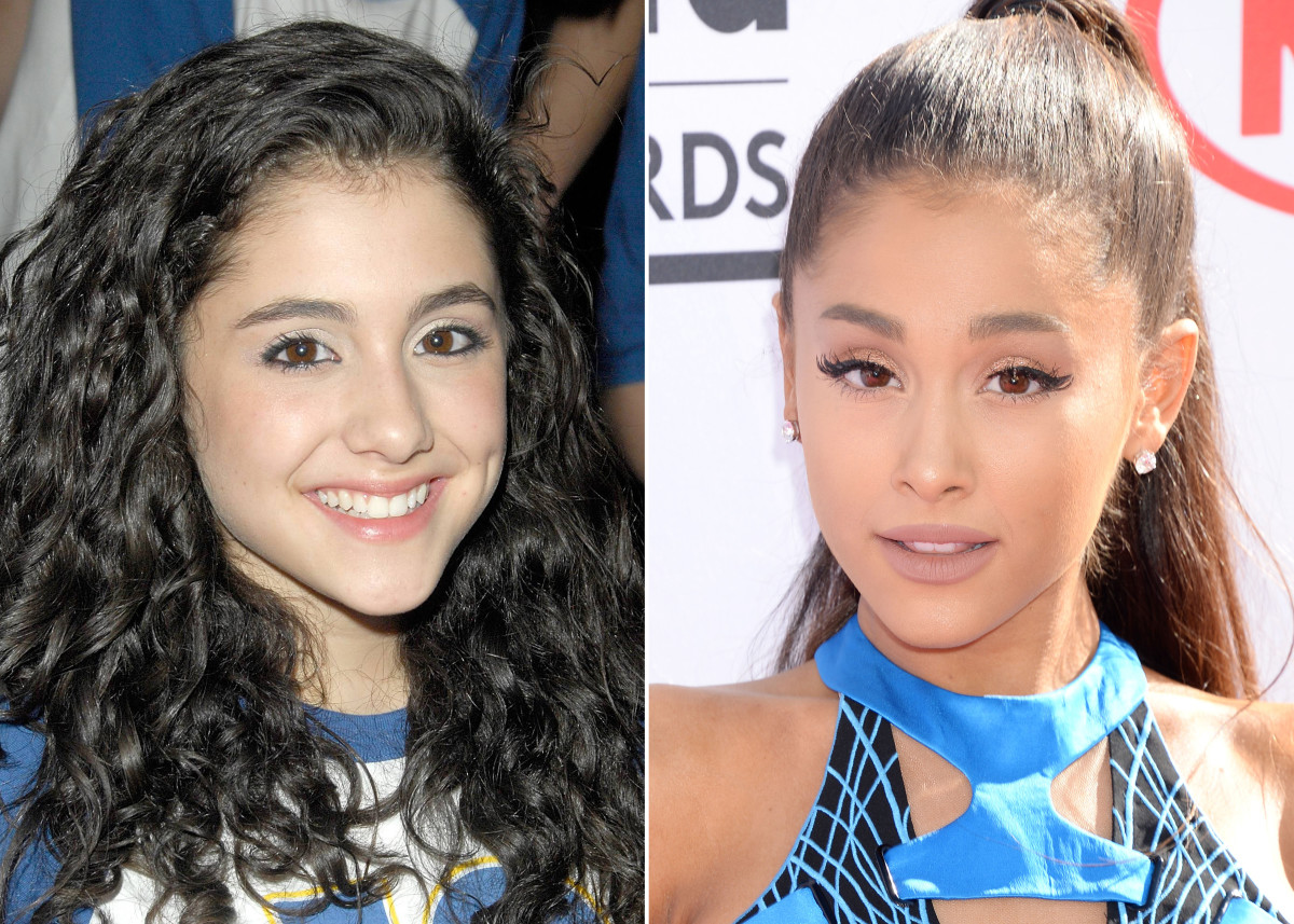 Ariana Grande Plastic Surgery Then and Now Compared