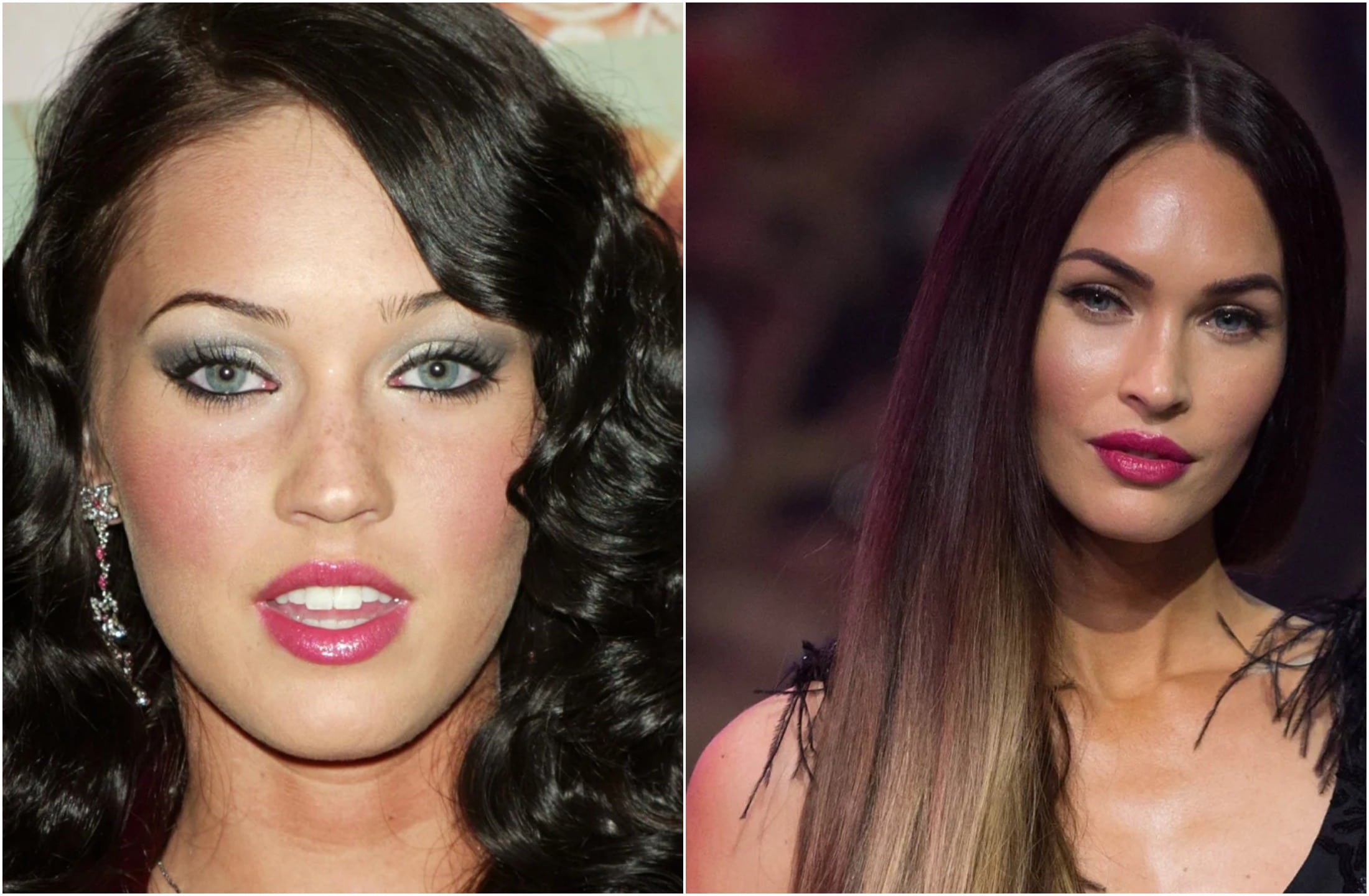 Megan Fox Plastic Surgery Before And After