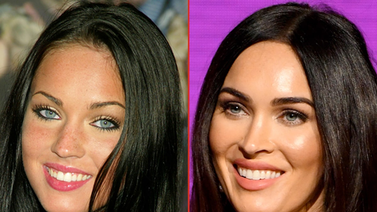 Are Megan Fox Plastic Surgery Rumors True? Women In The World