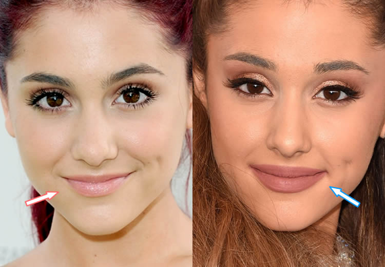 Ariana Grande Plastic Surgery: Then and Now Compared (2024)