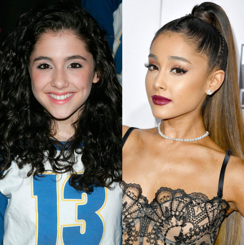 Ariana Grande Plastic Surgery: Then and Now Compared