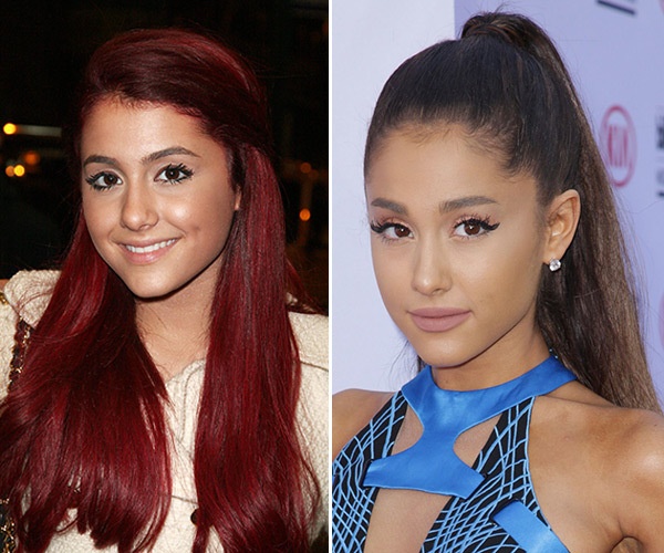 Ariana Grande Plastic Surgery: Then and Now Compared (2024)