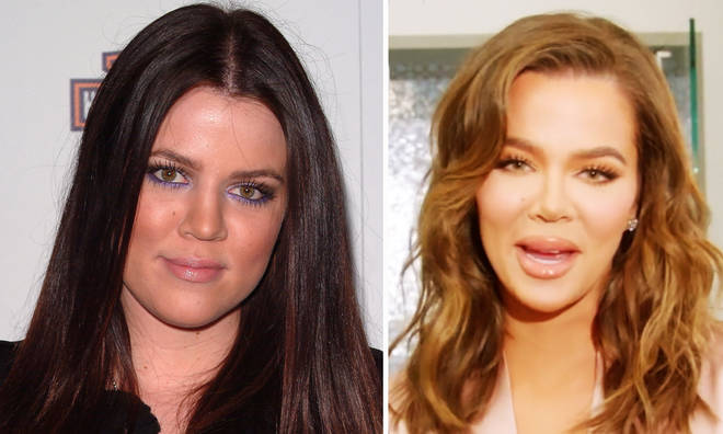 Khloe Kardashian Plastic Surgery Rumors Or Reality Women In The World 