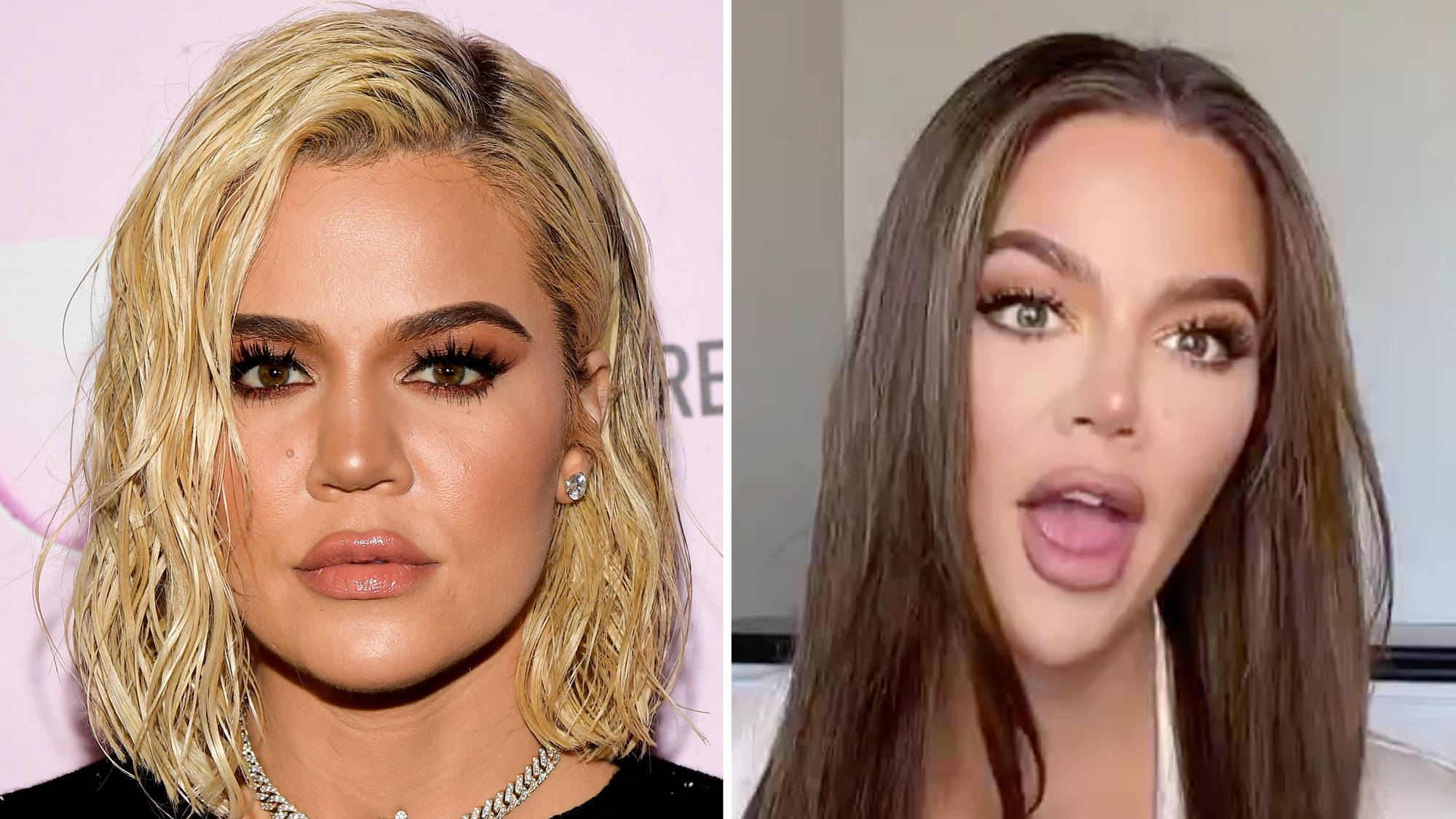 Khloe Kardashian Plastic Surgery Rumors or Reality? Women In The World