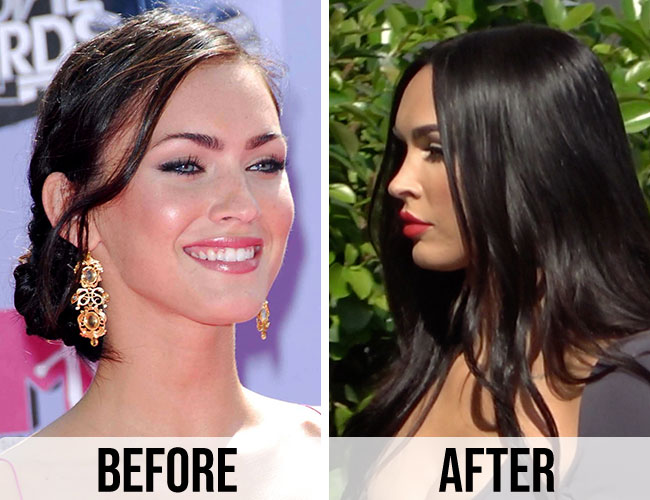 Are Megan Fox Plastic Surgery Rumors True Women In The World